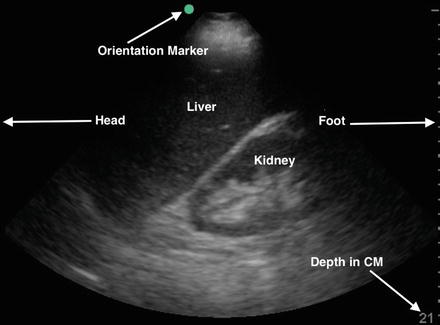 Abdominal Scan